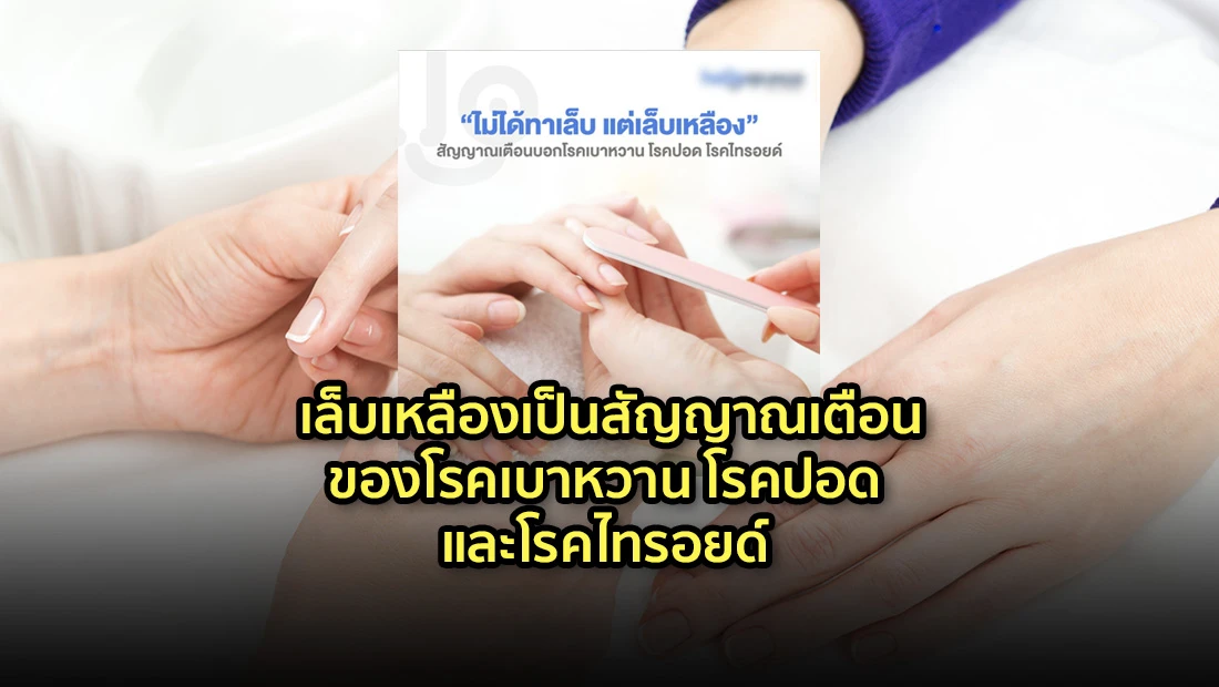 เล็บเหลืองเป็นสัญญาณเตือนของโรค