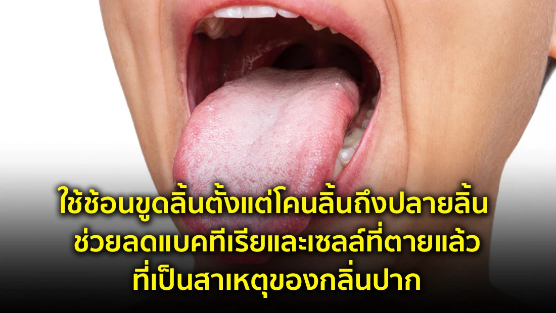 ใช้ช้อนขูดลิ้นตั้งแต่โคนลิ้นถึงปลายลิ้น ช่วยลดแบคทีเรีย