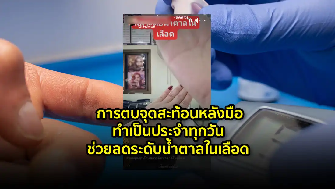 การตบจุดสะท้อนหลังมือทำเป็นประจำทุกวัน ช่วยลดระดับน้ำตาลในเลือด