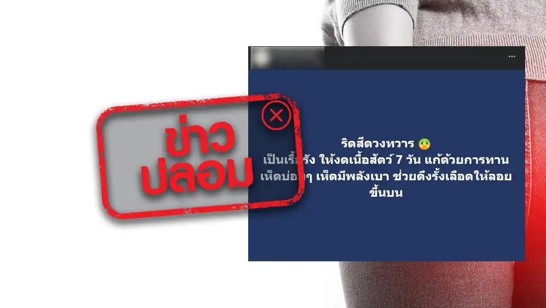 ริดสีดวง​ทวารเรื้อรัง รักษาได้โดยงดเนื้อสัตว์​ 7 วัน