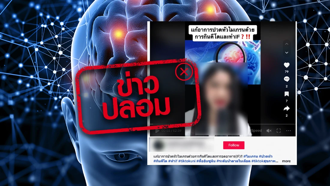 วิธีแก้ไมเกรน
