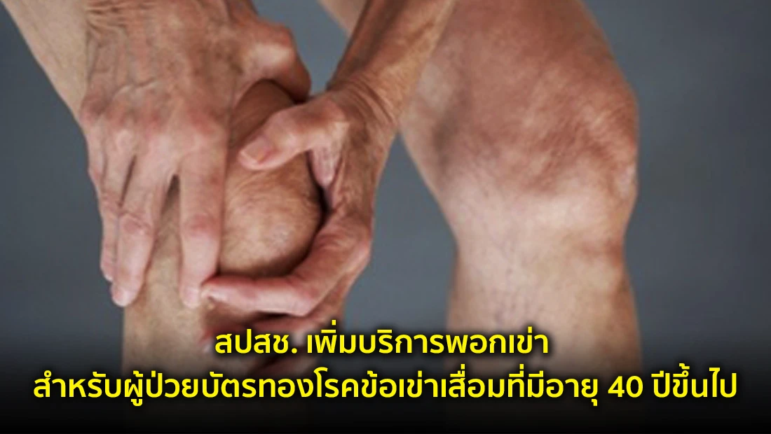 สปสช. เพิ่มบริการพอกเข่า สำหรับผู้ป่วยบัตรทอง