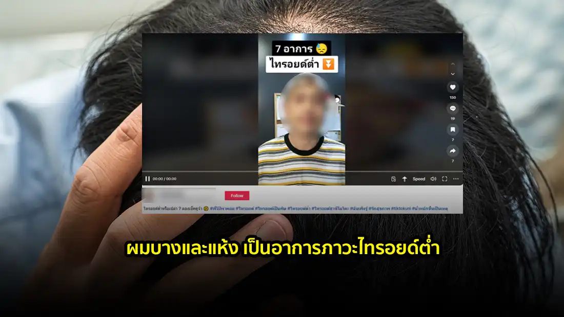 ภาวะไทรอยด์ต่ำ