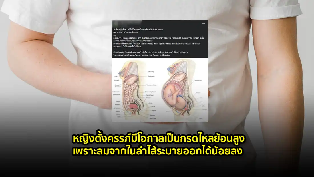 หญิงตั้งครรภ์มีโอกาสเป็นกรดไหลย้อนสูง