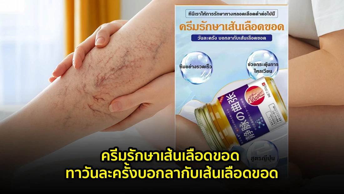 ครีมรักษาเส้นเลือดขอด