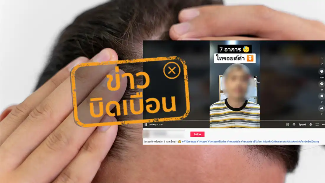ภาวะไทรอยด์ต่ำ