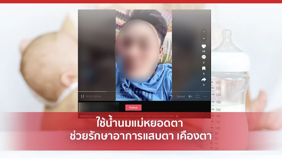 ใช้น้ำนมแม่หยอดตา ช่วยรักษาอาการแสบตา เคืองตา