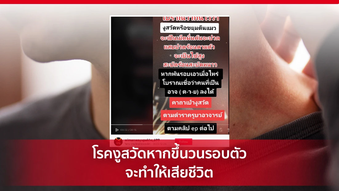 โรคงูสวัด