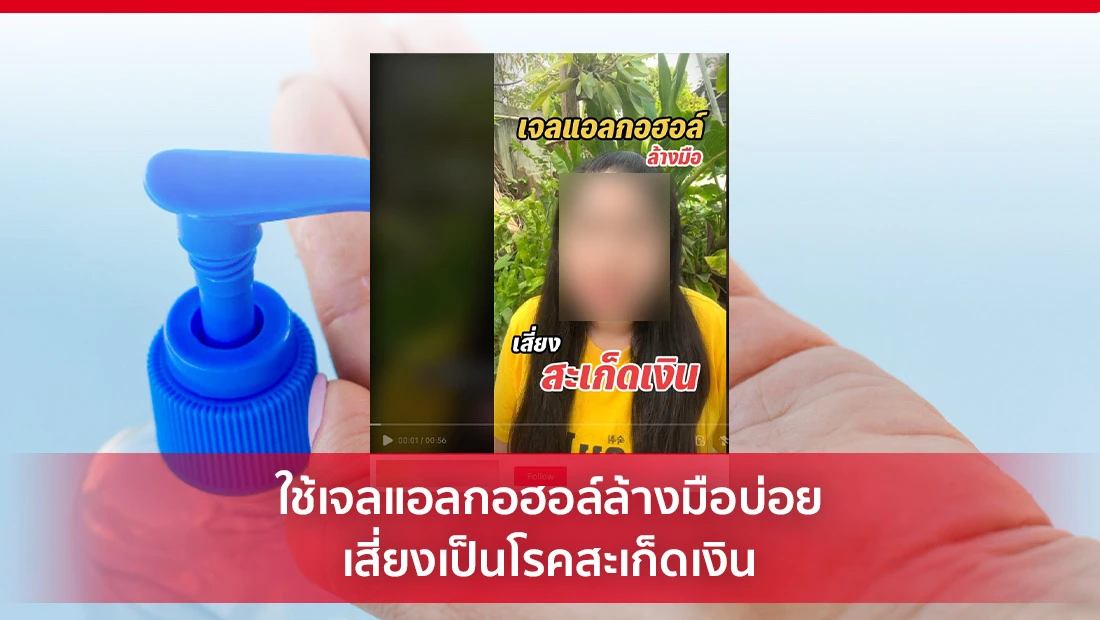โรคสะเก็ดเงิน