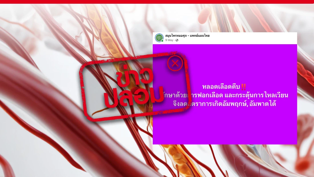 หลอดเลือดตีบ