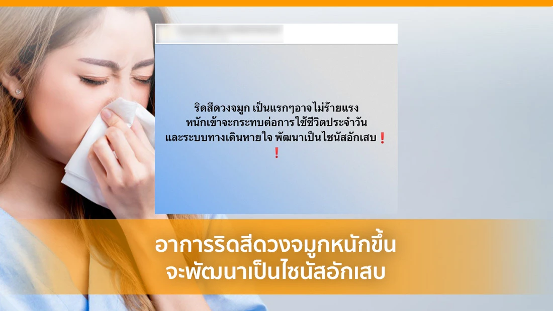 ริดสีดวงจมูก