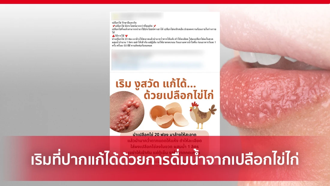 เริมที่ปาก