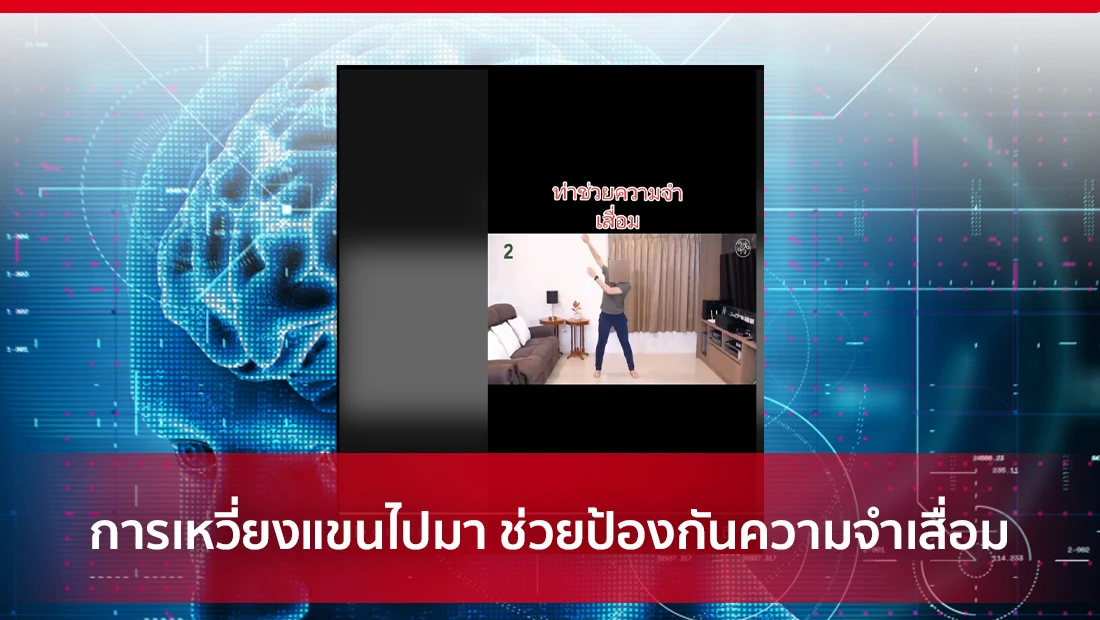 การเหวี่ยงแขน