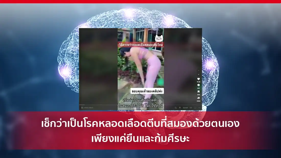 เช็กว่าเป็นโรคหลอดเลือดตีบที่สมองด้วยตนเอง