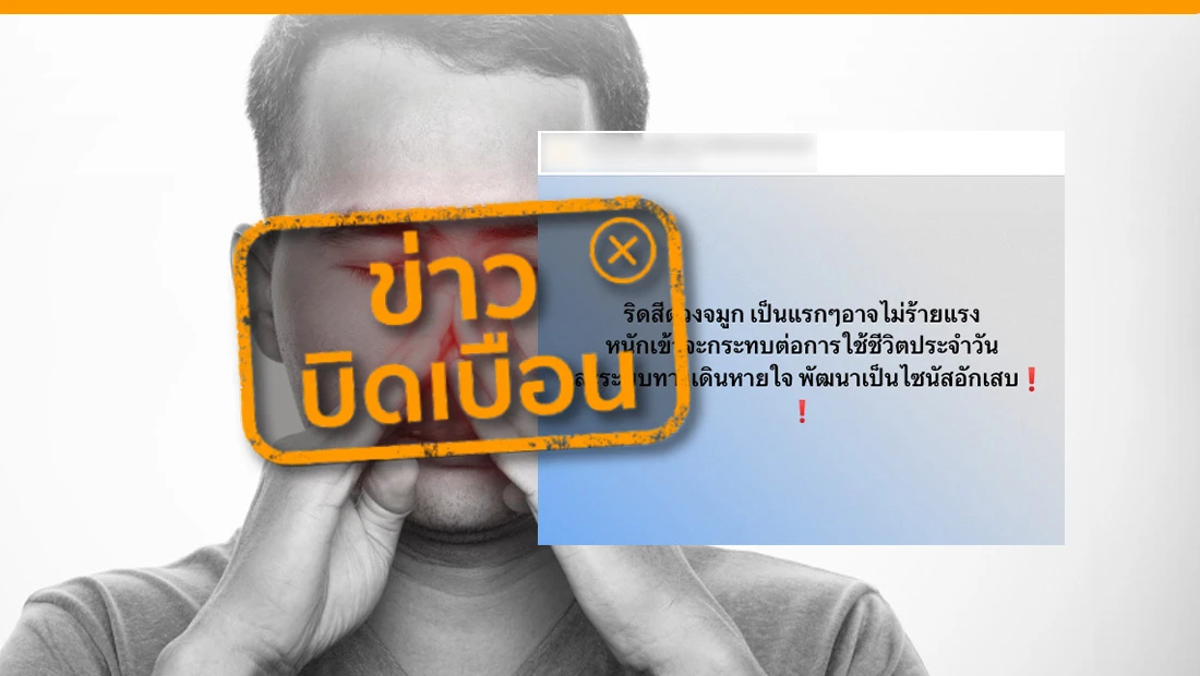 ริดสีดวงจมูก