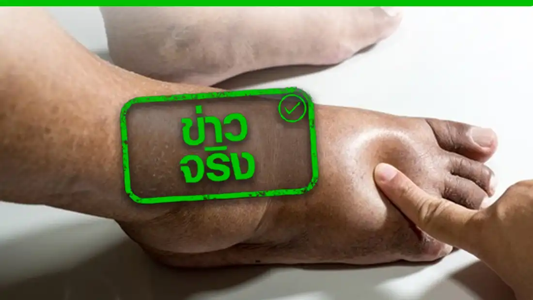 สัญญาณเตือนของโรคหัวใจ