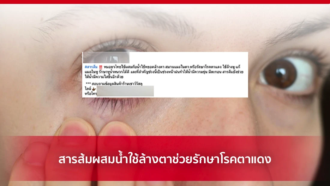 สารส้มผสมน้ำใช้ล้างตาช่วยรักษาโรคตาแดง
