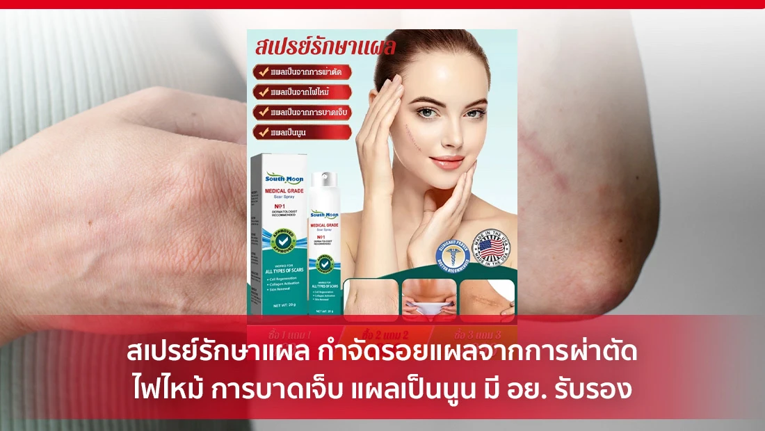 สเปรย์รักษาแผล