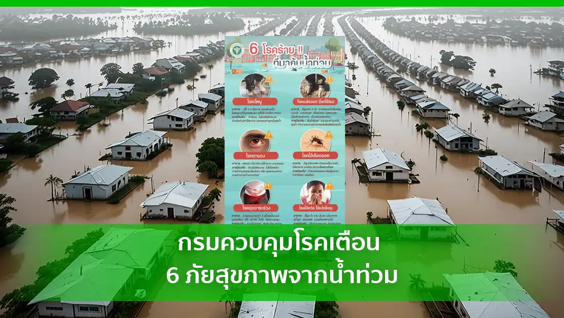 กรมควบคุมโรคเตือน 6 ภัยสุขภาพจากน้ำท่วม