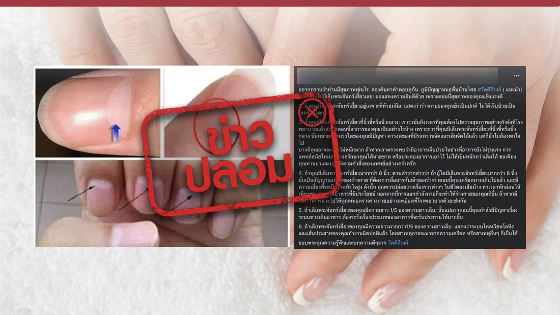 พระจันทร์เสี้ยวในเล็บมือ
