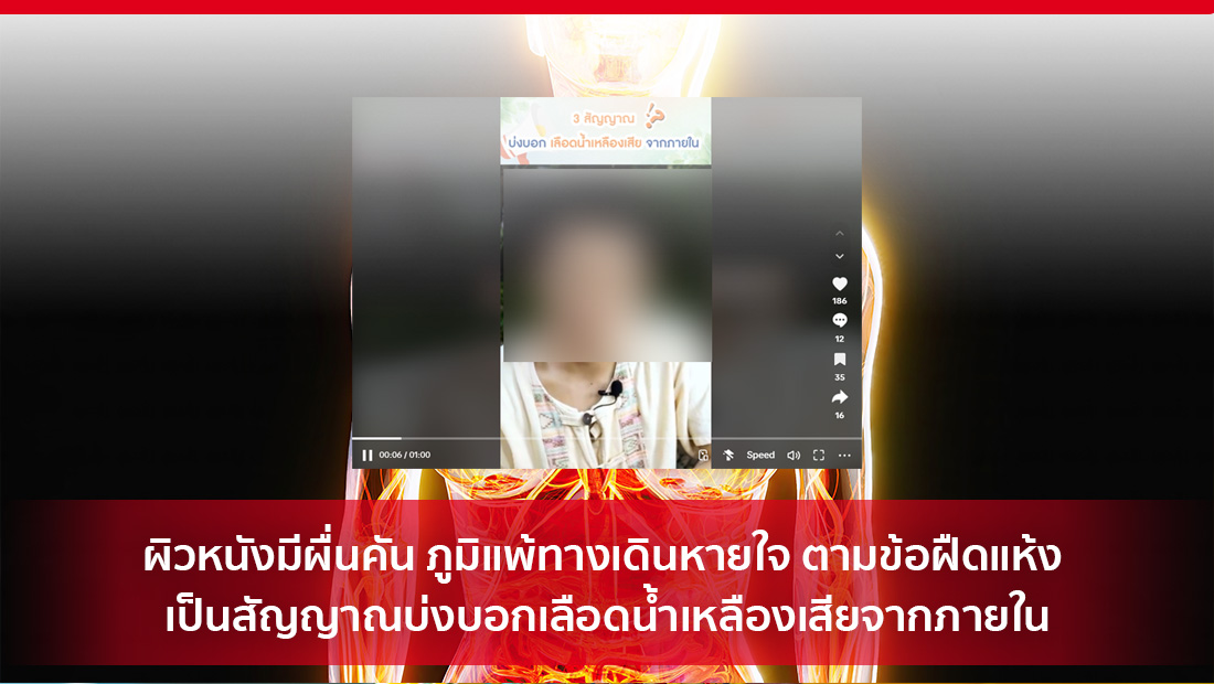 เลือดน้ำเหลืองเสียจากภายใน