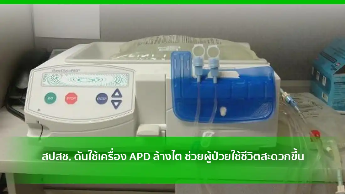 สปสช. ดันใช้เครื่อง APD ล้างไต ช่วยผู้ป่วยใช้ชีวิตสะดวกขึ้น