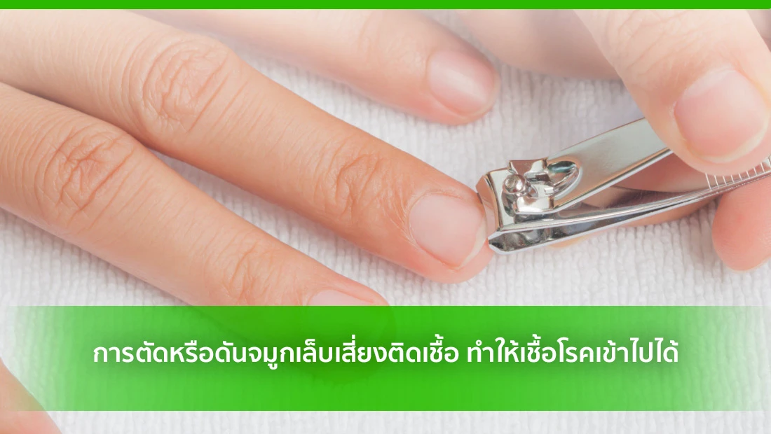 จมูกเล็บ