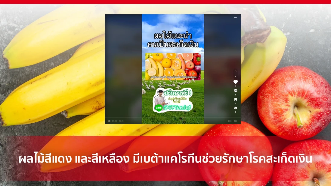 รักษาโรคสะเก็ดเงิน