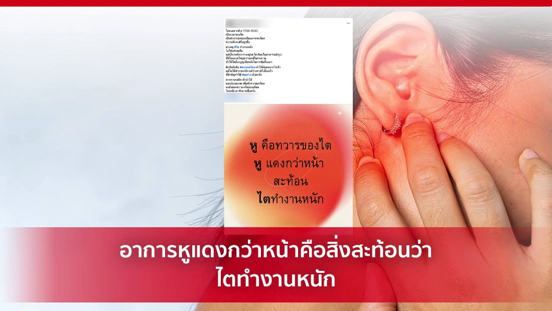 หูแดงกว่าหน้า