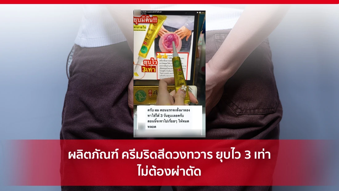 ครีมริดสีดวงทวาร