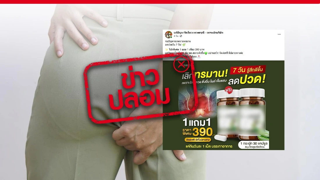 ผลิตภัณฑ์ ดวงดรุณี ช่วยรักษาริดสีดวงเห็นผลภายใน 7 วัน