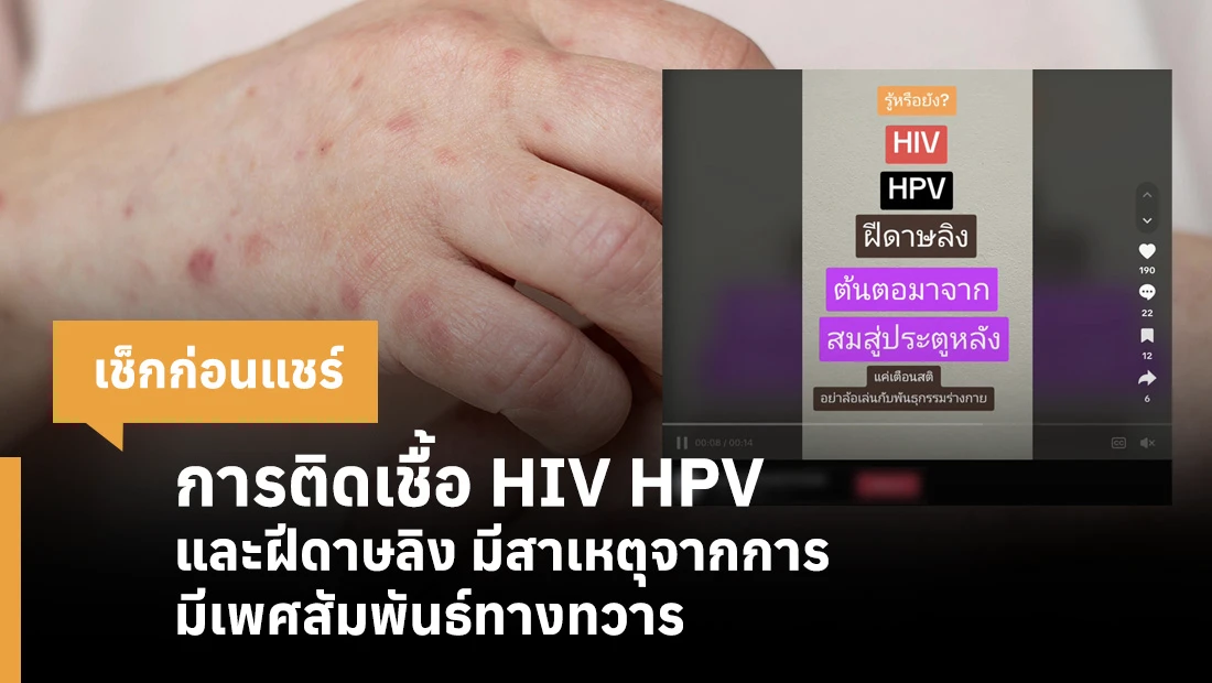 การติดเชื้อ HIV HPV และฝีดาษลิง มีสาเหตุจากการมีเพศสัมพันธ์ทางทวาร