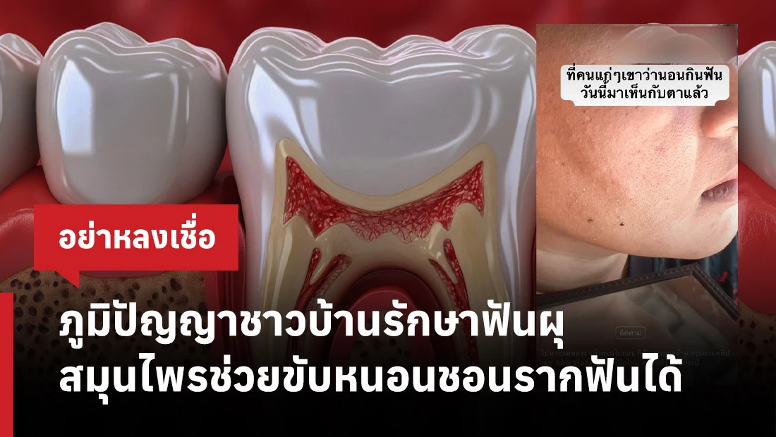 สมุนไพรช่วยขับหนอนชอนรากฟัน