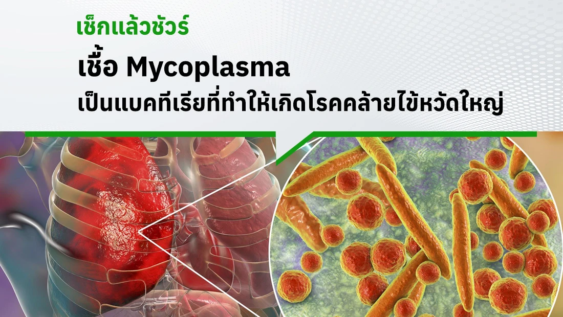 เชื้อ Mycoplasma