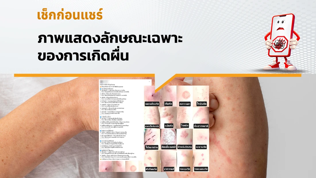 ภาพแสดงลักษณะเฉพาะของการเกิดผื่น 