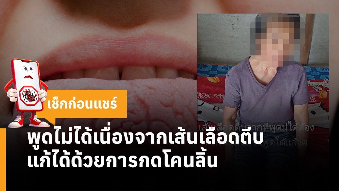 พูดไม่ได้เนื่องจากเส้นเลือดตีบ แก้ได้ด้วยการกดโคนลิ้น