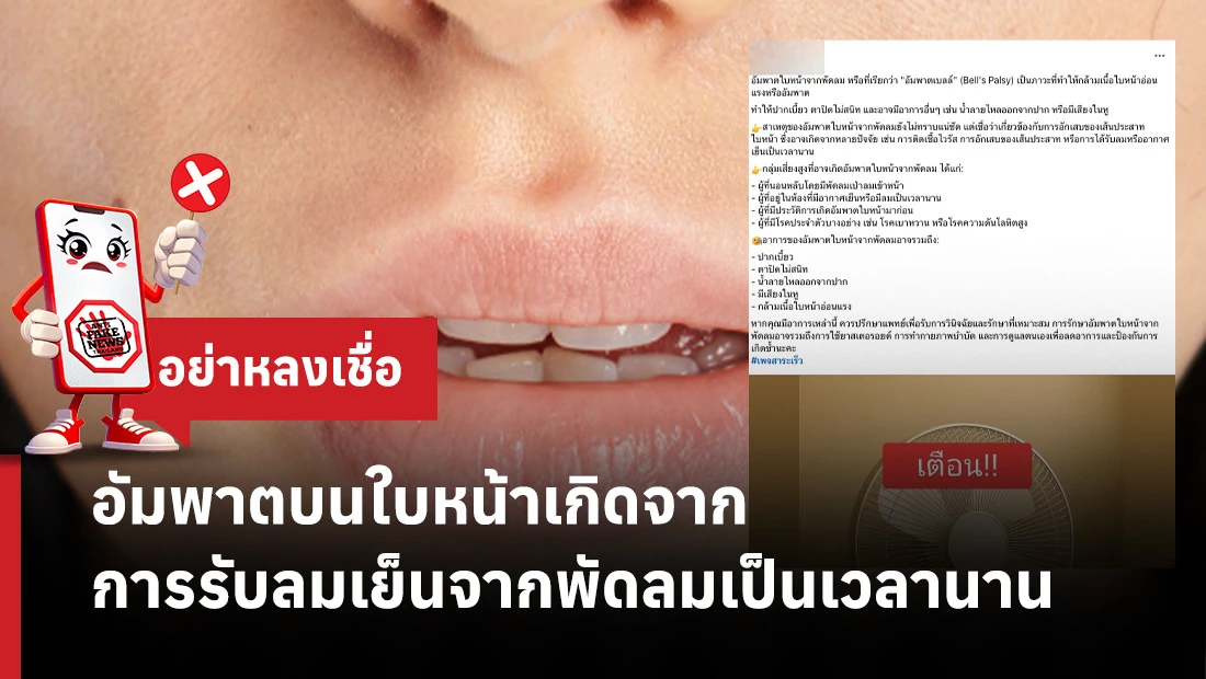 อัมพาตบนใบหน้า