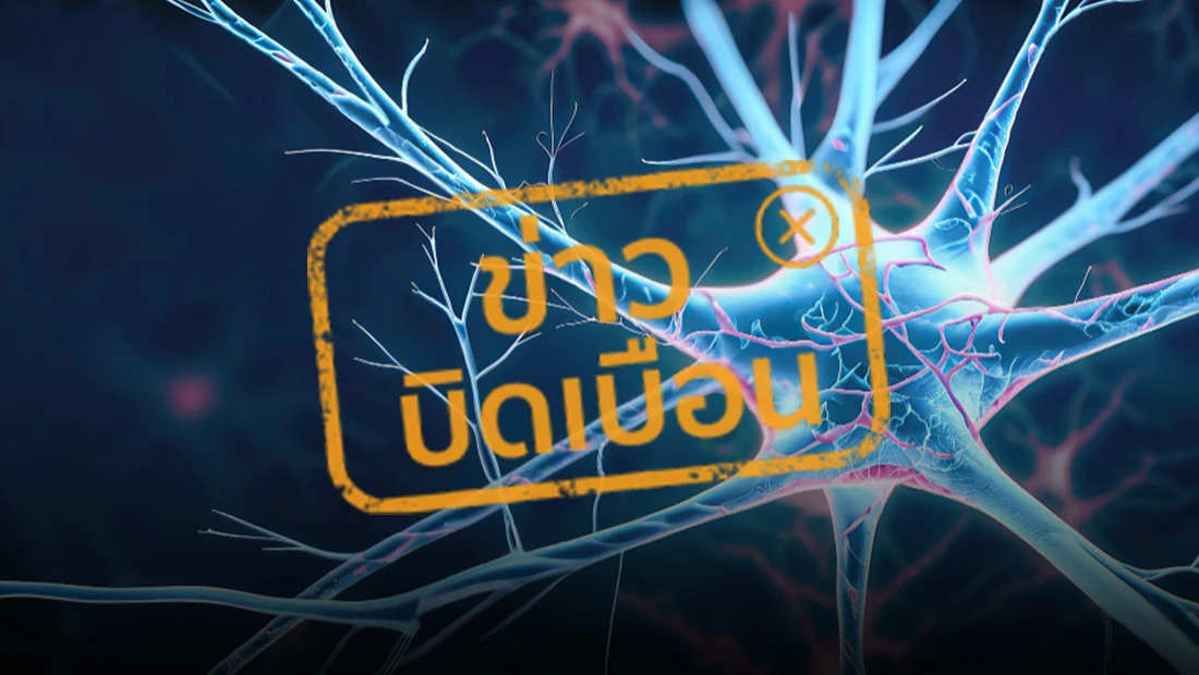 โรคหมอนรองกระดูกทับเส้นประสาท โรคหมอนรองกระดูกทับเส้นประสาท