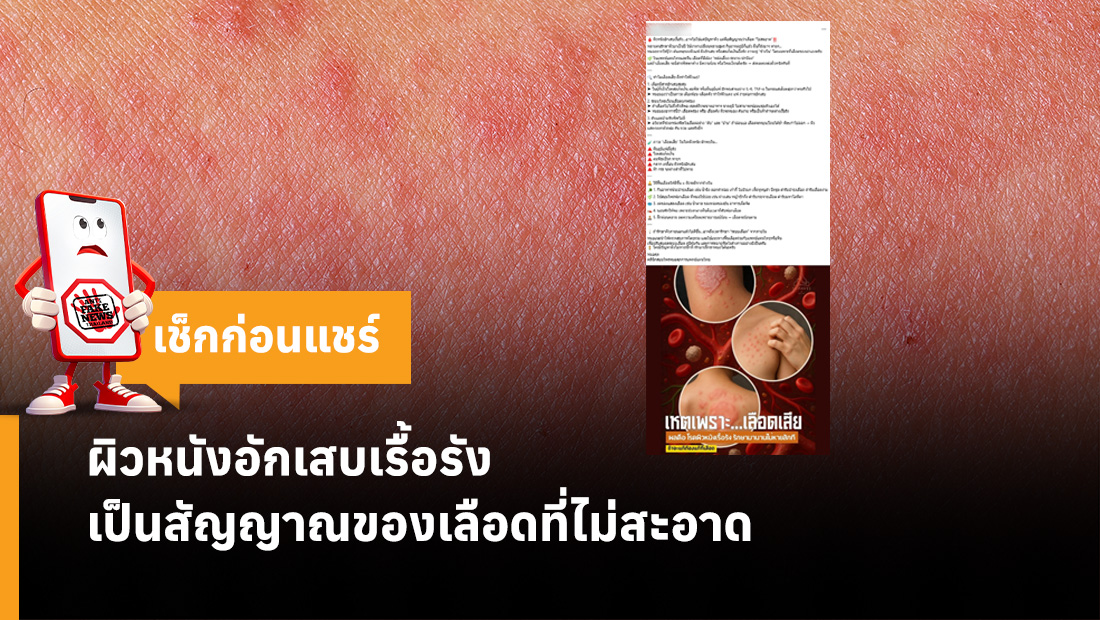 ผิวหนังอักเสบเรื้อรัง เป็นสัญญาณของเลือดที่ไม่สะอาด