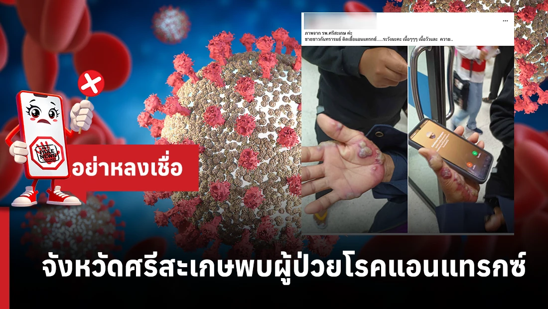 จังหวัดศรีสะเกษ พบผู้ป่วยโรคแอนแทรกซ์ 