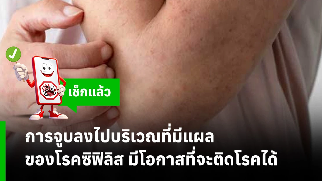 แผลของโรคซิฟิลิส